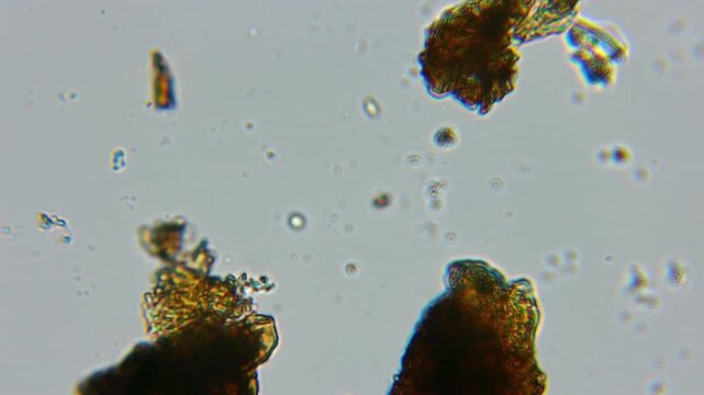 Microscope Examines Ground Soil Sample With Jagged Amber Mineral Fragments and Organic Debris Floating Among Translucent Microparticles. Rusty Brown Clusters and Iridescent Edges Dot a Pale Gray Field