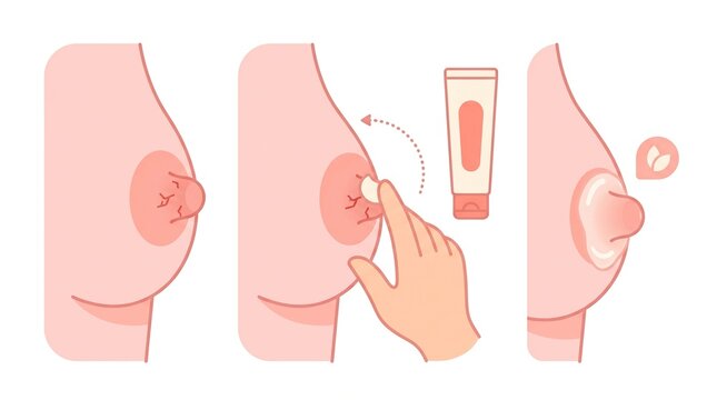 Visual guide showing a hand applying lanolin cream on the nipple for postpartum care and recovery during the fourth trimester.