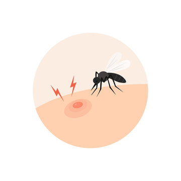 The  mosquito is on the body.Itch, allergy, red marks from insect bites. Dermatology problems, allergic reaction on body.Vector Illustration