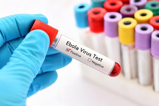 Ebola virus test tube positive result for the concept of medical research and epidemic.