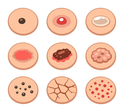 Assorted skin issues and concerns such as a variety of rashes, moles, acne, blisters, burns, and ongoing medical conditions