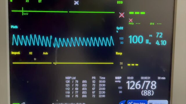 Patient monitor screen showing vital signs and heartbeat waveform in hospital clinic.