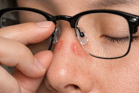 A close-up photo of someone wearing glasses