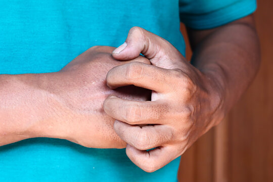 Asian man's hand Scratching itchy wrist close up
