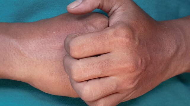 Asian man's hand Scratching itchy wrist close up