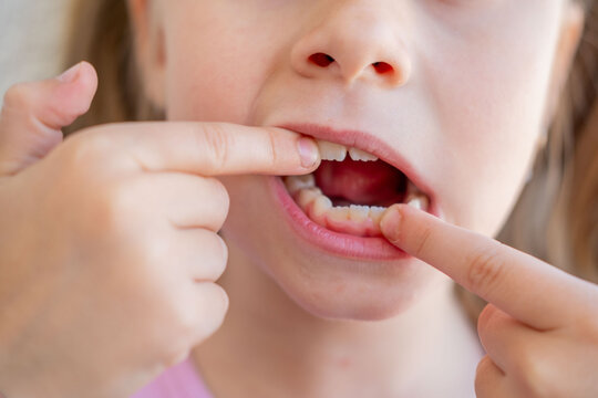 young girl pointing gap in teeth, losing first milk tooth, dental care concept, growing up, childhood development, oral hygiene, Pediatric dentistry, natural transition baby teeth to permanent ones