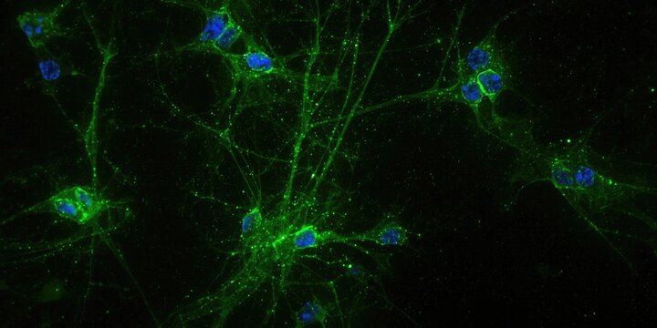 Cultured glial brain astrocytes labeled using GFAP green and DAPI blue for nuclei with copy space