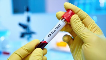 Fototapeta premium Laboratory sample tube for Ebola virus testing in medical research facility during infectious disease screening with outbreak preparedness public health response