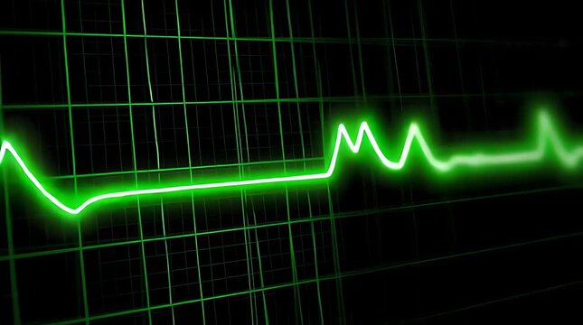 A bright green electrocardiogram line displays a heartbeat rhythm on a dark grid background.