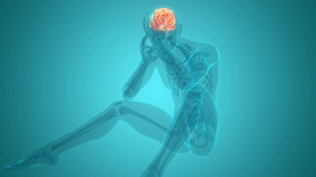 Human Suffering with Severe Headache Anatomy Animation Concept