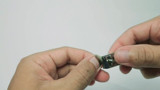 Close-up shot of adult hands using a stainless steel nail clipper to carefully trim a fingernail. The finger shows a visible healing wound and bruising from a previous blunt force injury. The person d