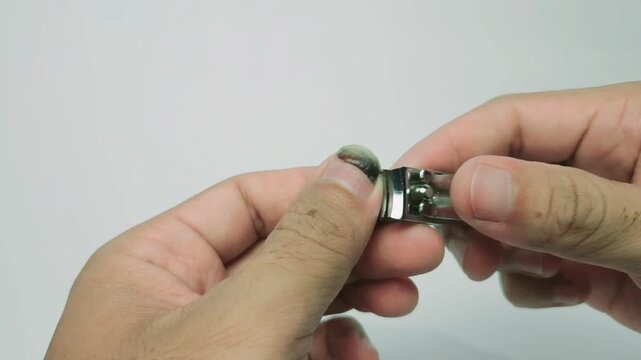 Close-up shot of adult hands using a stainless steel nail clipper to carefully trim a fingernail. The finger shows a visible healing wound and bruising from a previous blunt force injury. The person d