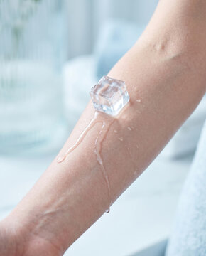 Ice cube melting on human arm skin close up water drops cooling effect skincare first aid concept