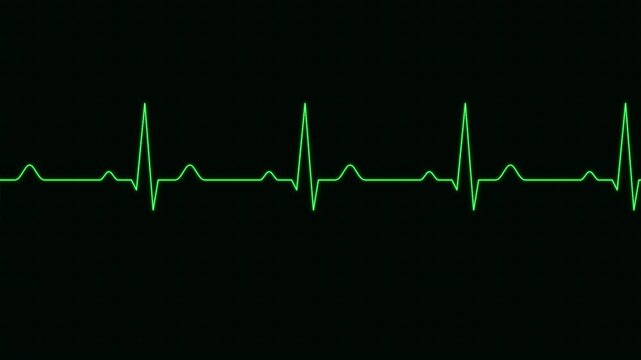 heart rate monitor ekg line pulse overlay effect