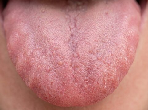 Macro view of human tongue surface with papillae close-up physiology clinical