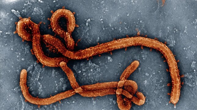 Electron micrograph of ebola virus particles