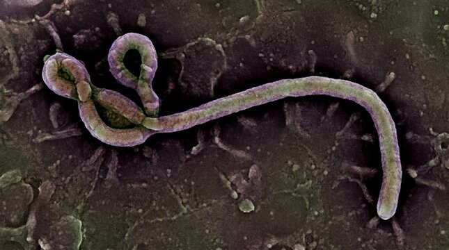 Ebola virus particle
