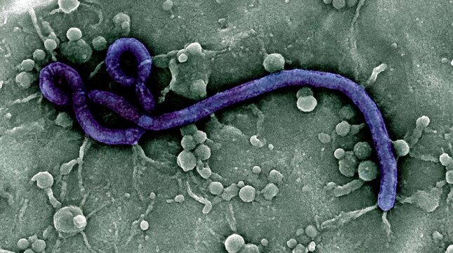 Ebola virus particle under an electron microscope