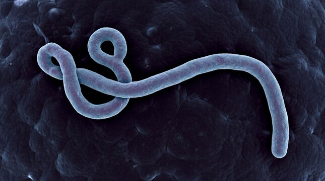Colored scanning electron micrograph of an ebola virus particle