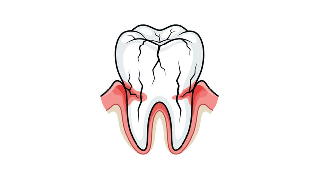 Cracked Tooth and Gum Inflammation Vector Illustration