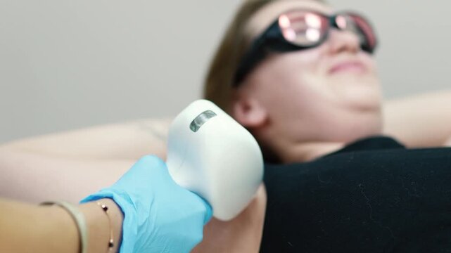 Beauty master makes laser hair removal epilation of armpits close-up in a beauty salon for a girl with beautiful smooth body