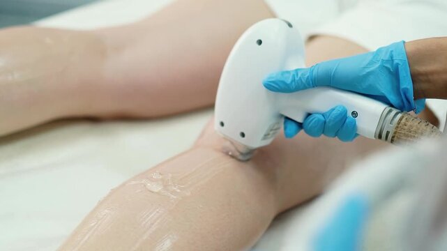 Beauty master makes laser hair removal epilation of legs skin close-up in a beauty salon for a girl with beautiful smooth body