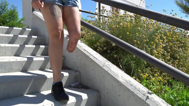 Woman with a leg amputation confidently hopping down a flight of concrete stairs. Daily life and overcoming physical challenges and disabilities