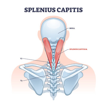 Splenius capitis muscle with anatomical skeletal neck part outline diagram, transparent background. Labeled educational scheme with medical muscular system with C7 and T3 bones illustration.