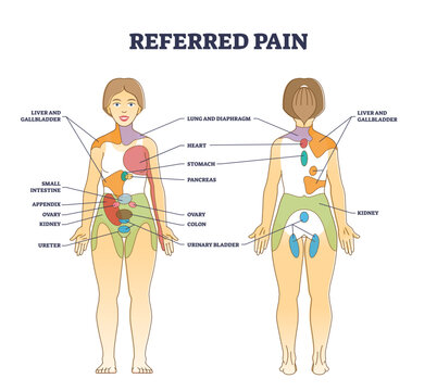 Referred pain location as body painful stimulus organ origin outline diagram, transparent background. Labeled educational chart with problem zones projection illustration.