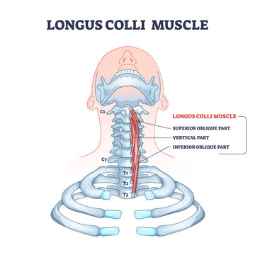 Longus colli muscle with superior, vertical and inferior part outline diagram, transparent background. Labeled educational human neck skeletal and muscular anatomy description illustration.