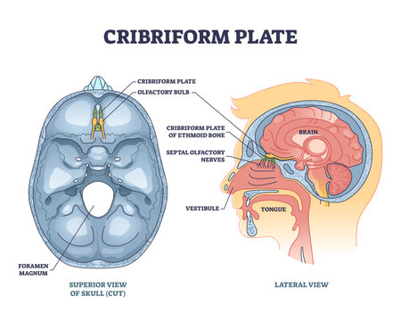 Cribriform plate of ethmoid bone location in head outline diagram, transparent background. Labeled educational anatomical scheme.