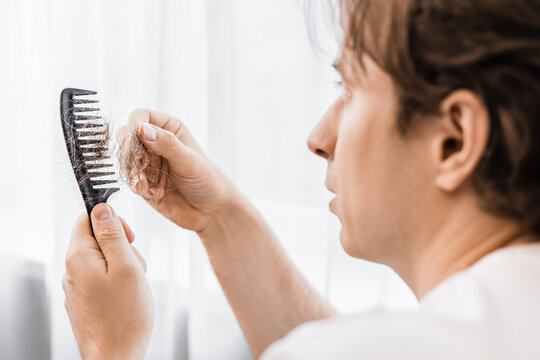 Worried man holding a comb during grooming, examining shedding hair. Concept of stress, alopecia, testosterone, and male hair loss.