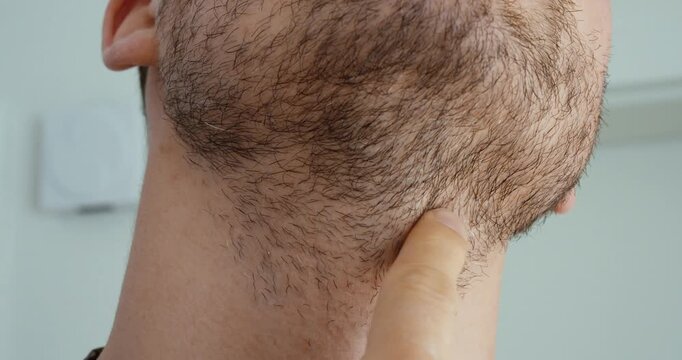 Unshaven Neck Hair and Uneven Beard Line Close Up