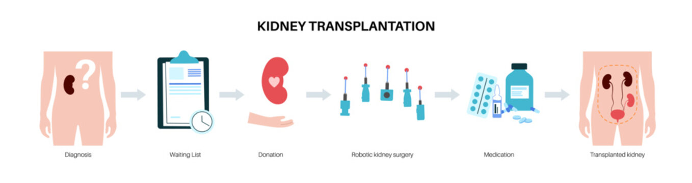 Kidney transplant surgery