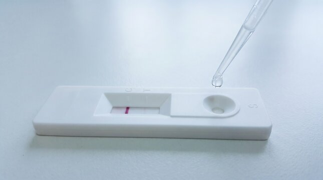 A person uses a pipette to add a liquid sample to a rapid diagnostic test kit on a white surface in a laboratory setting for health analysis.