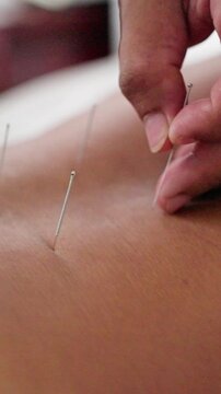 Precise Needle Insertion. Expert Performs Delicate Injection Around Belly Button Area. Focused Clinician Carefully Guides Sterile Needles Into Skin With Gentle Pinch Technique Near Navel