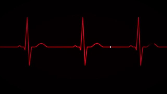 Red heartbeat pulse line green screen motion graphic