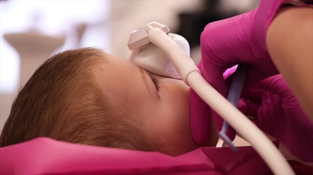 Close up footage of a child receiving inhalation sedation through a mask before a dental procedure. A dental professional wearing protective gloves carefully positions the equipment to help the young 