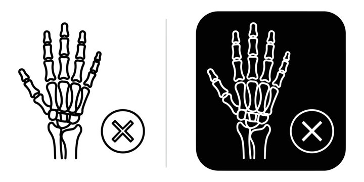X-ray hand skeleton with prohibition sign for medical warning or no access concepts