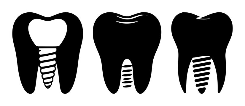 Dental implant tooth icon set with solid black icon on white background featuring dental, implant, tooth with iconography and white backdrop