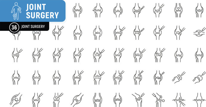 Detailed vector illustration showing sequential stages of knee joint surgery and replacement procedure in flat line art style.
