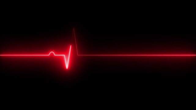 Which indicates the death of the patient. Heartbeat line without pulse