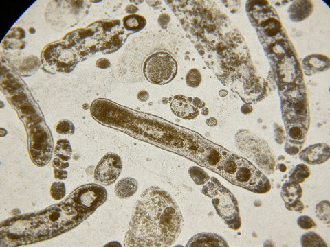 Original optical micrograph of *Actinomyces israelii*, Gram-stained, a genuine clinical microbial sample, with natural and uneven staining.