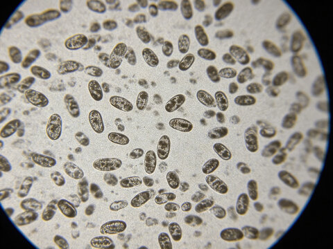 Original optical micrograph of *Francisella tularensis*, Gram staining, authentic clinical sample, micrococcus, naturally uneven staining.
