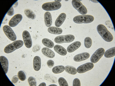 Original optical micrograph of Brucella oruttus, Gram staining, a true zoonotic pathogen, a small cocci, with naturally uneven staining.
