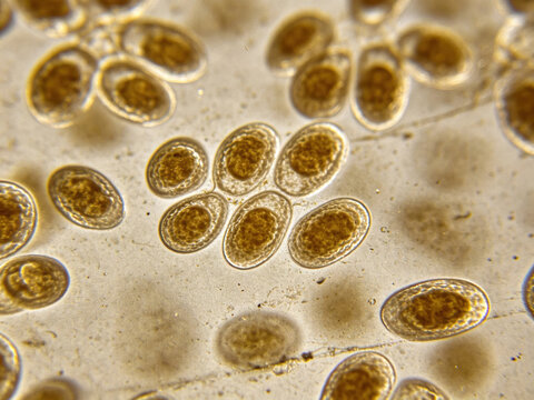 Original transmission electron micrograph of Ureaplasma urealyticum, showing minute pleomorphism and lack of cell wall.