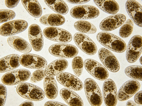 Original image of Streptococcus pneumoniae, Gram staining; the diplococci are lanceolate in shape and have capsules.