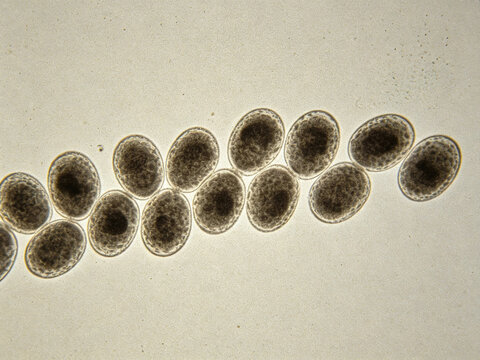 Original image of Group B Streptococcus agalactiae, Gram staining, stroma.