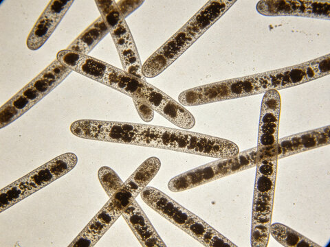 Original image of Erysipelothrix rhusiopathiae, Gram staining, swine erysipelas, slender rod-shaped bacterium.