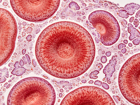 Original Wright-Gimsafa photomicrographs showing human red blood cells, characterized by their biconcave disc shape, typical of normal red blood cells, in a natural blood smear.